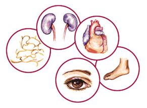 Organoak diabetearen mellitus-en konplikazioak